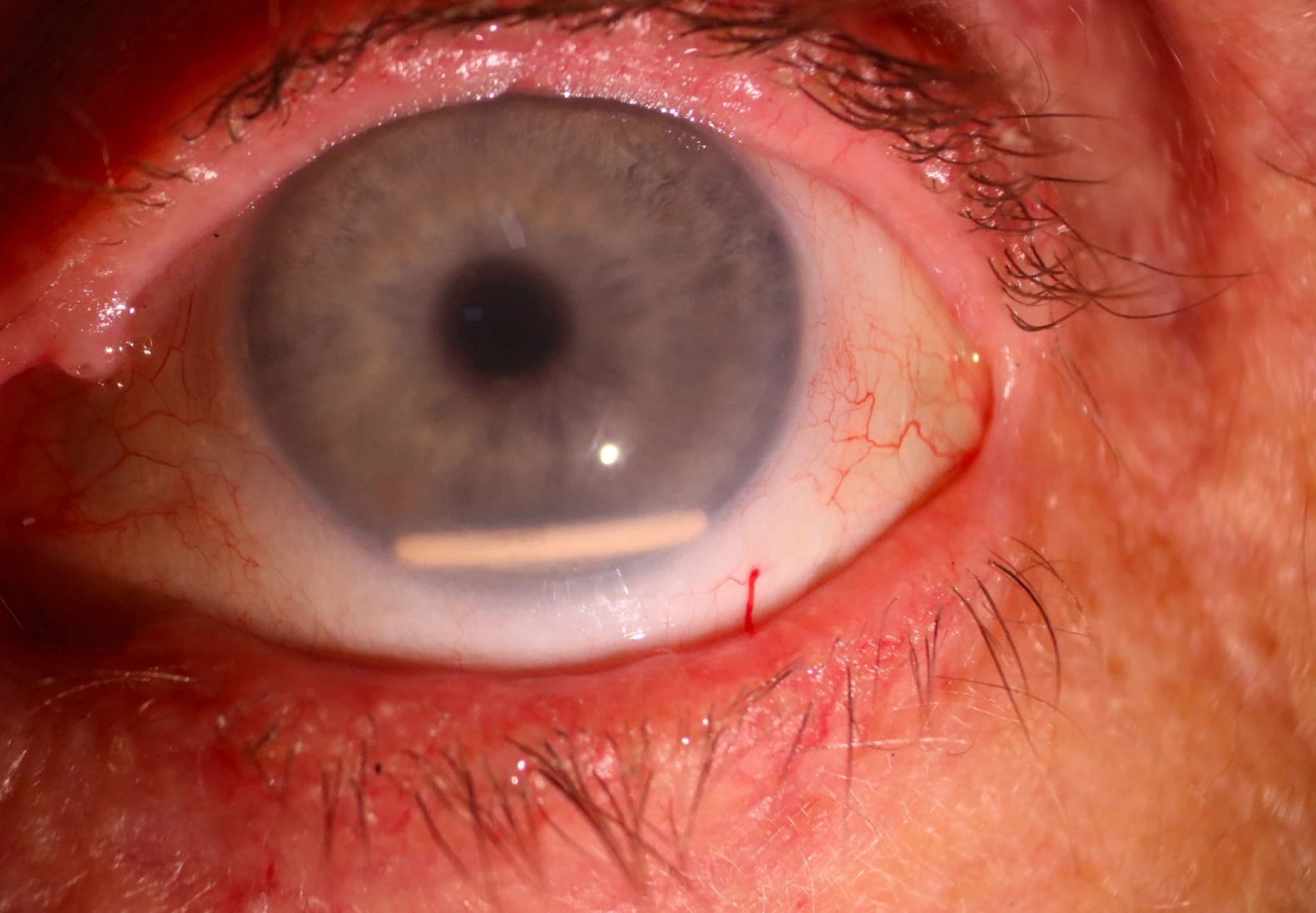 Photo of eye